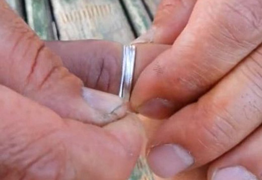 To remove a ti...